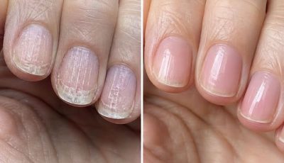 Soak your nails in this 1 mixture and get rid of brittle ridges, vertical lines, and flaky layers