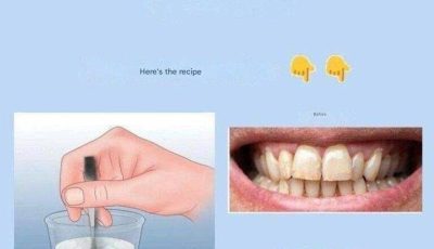Remove tartar and whiten your teeth with this simple recipe.