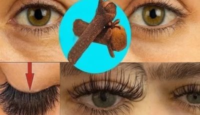 Grandma’s Beauty Secret: Thick Eyebrows and Long Eyelashes in 7 Days Thanks to Cloves