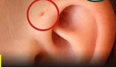 👂🔍 Discover the Meaning of This Particular Mark on the Ear… What Does It Really Indicate?