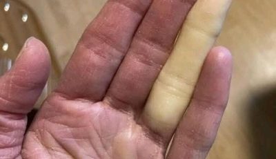 These are the consequences of sleeping with the… See more